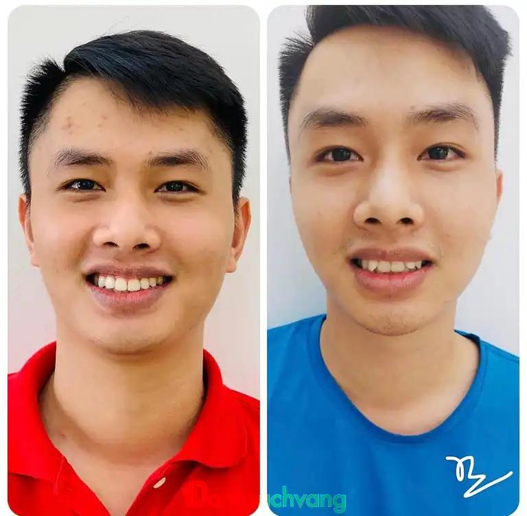 Hình ảnh nha-khoa-ngan-ha-galaxy-dental-clinic-3