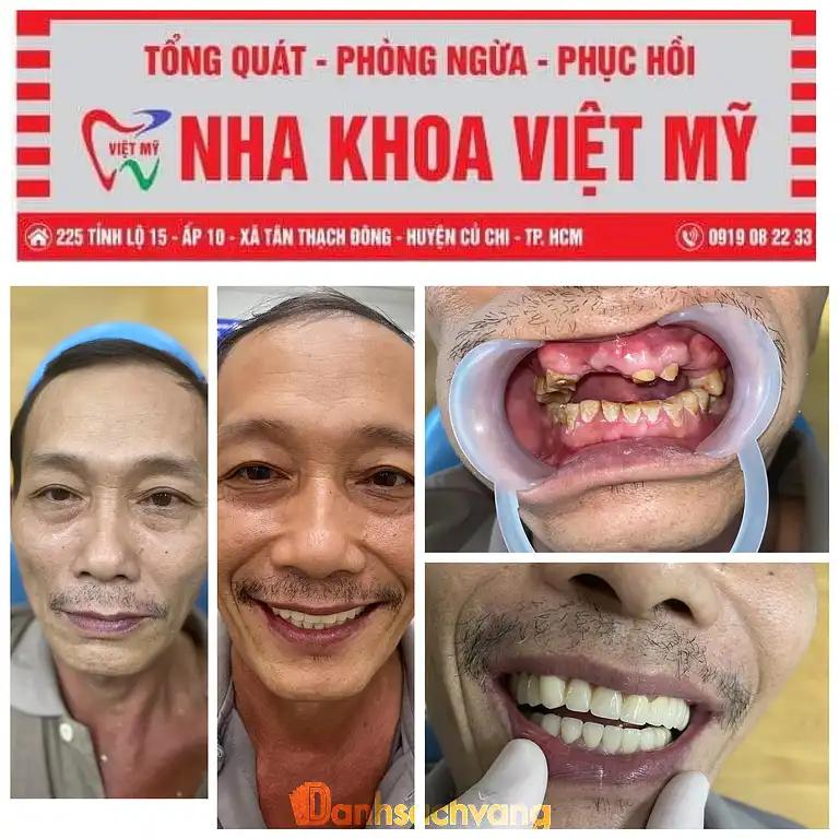 Hình ảnh nha-khoa-viet-my-cu-chi-3