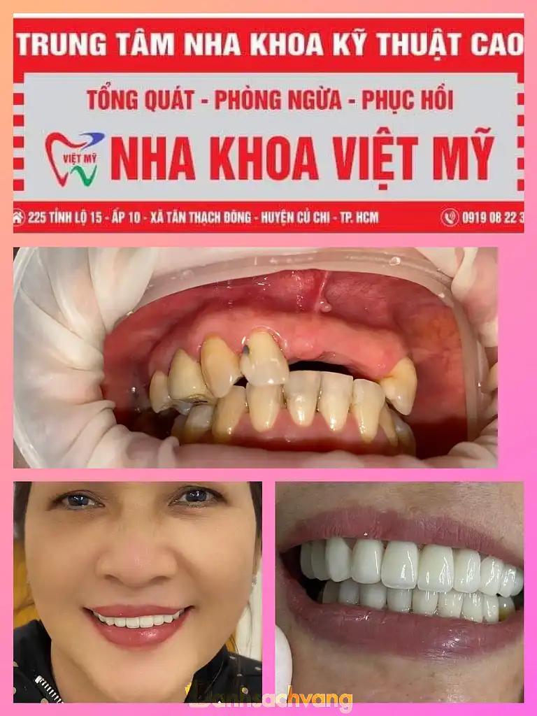 Hình ảnh nha-khoa-viet-my-cu-chi-4