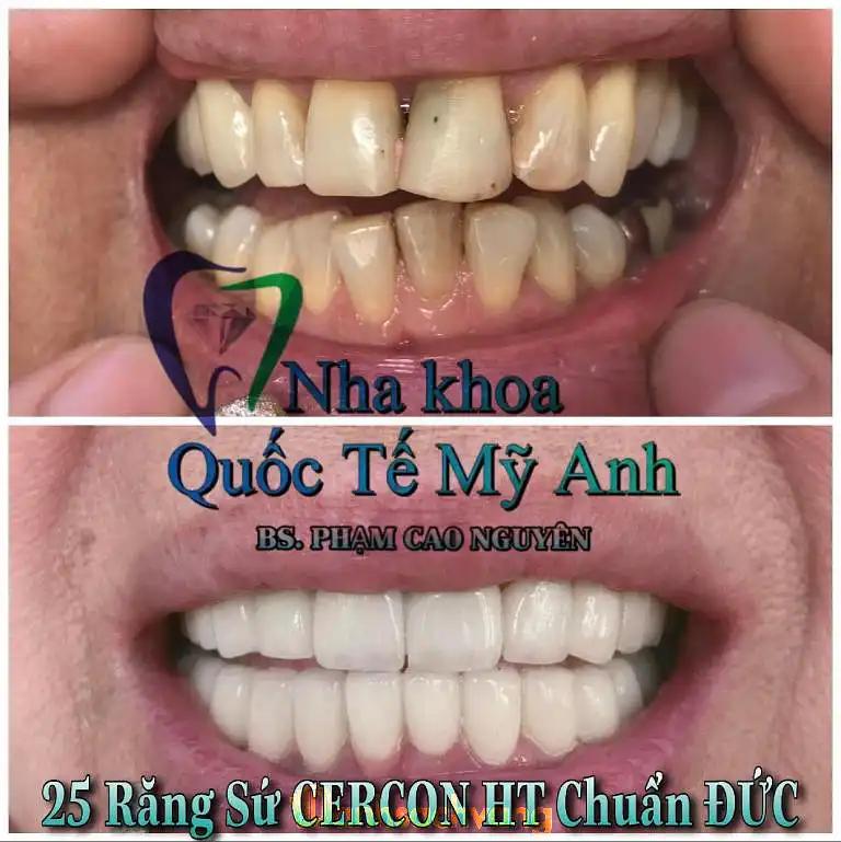 Hình ảnh Nha khoa Quốc tế Mỹ Anh: 45/3 Lê Thị Hà, Hóc Môn