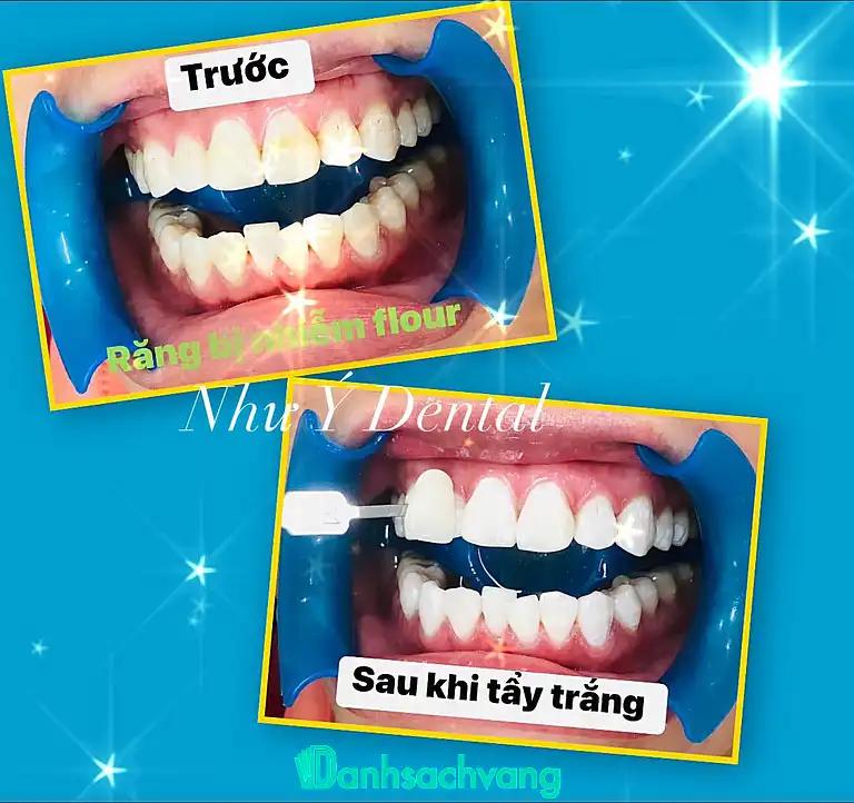 Hình ảnh nha-khoa-nhu-y-doc-lap-q-tan-phu-tphcm-3