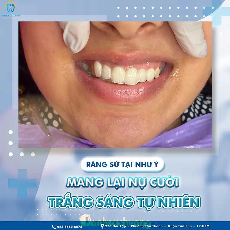 Hình ảnh nha-khoa-nhu-y-doc-lap-q-tan-phu-tphcm-5