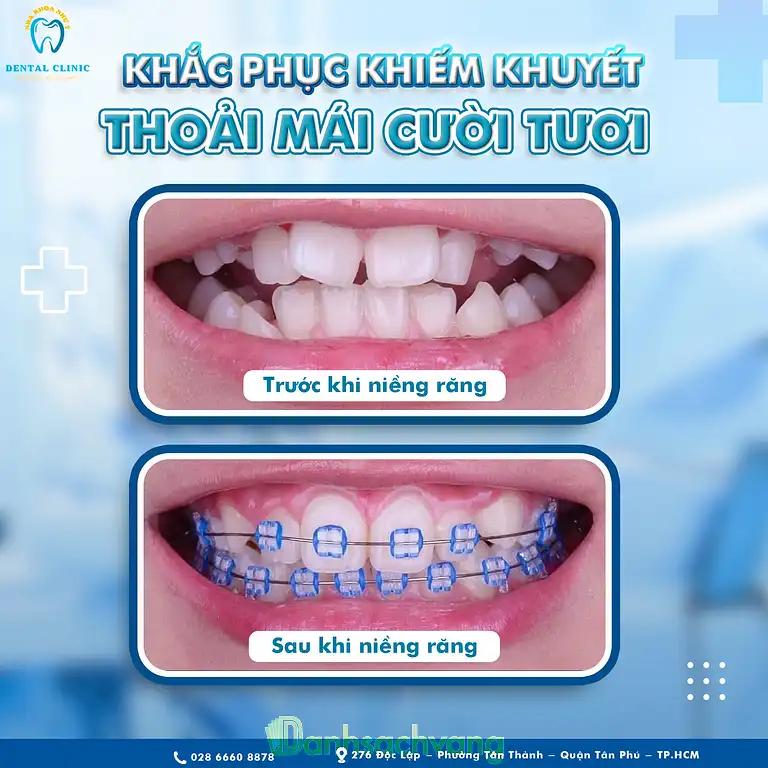 Hình ảnh nha-khoa-nhu-y-doc-lap-q-tan-phu-tphcm-4