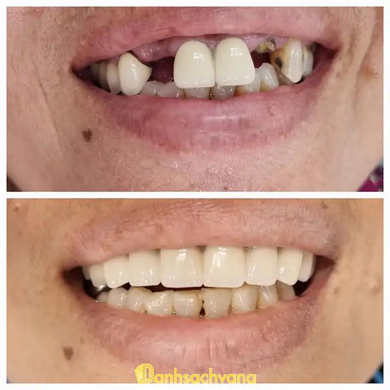Hình ảnh nha-khoa-nguyen-hung-tinh-lo-15-cu-chi-tphcm-2