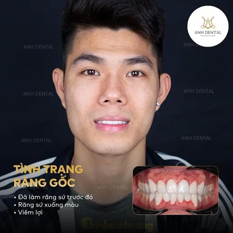 Hình ảnh vien-nha-khoa-tham-my-anh-dental-khuong-viet-qtan-phu-tphcm-5