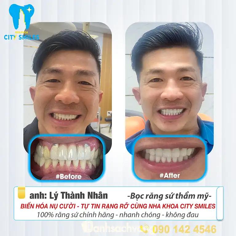 Hình ảnh nha-khoa-city-smiles-tan-huong-q-tan-phu-tphcm-4