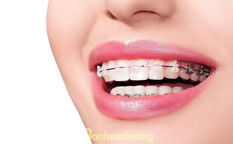 Hình ảnh dia-chi-nieng-rang-tai-tphcm-00