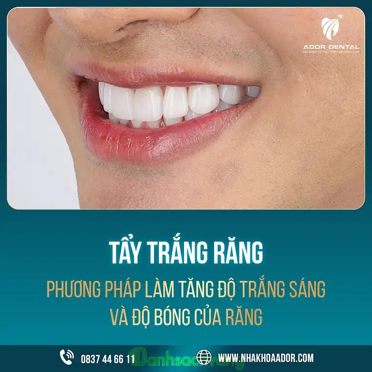 Hình ảnh ador-dental-tinh-lo-8-cu-chi-tphcm-4