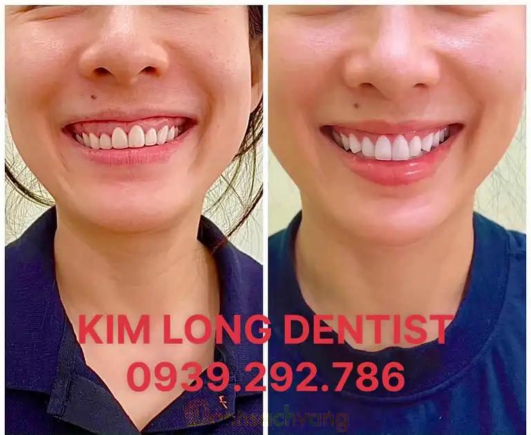 Hình ảnh kim-long-dental-tan-son-nhi-q-tan-phu-tphcm-2