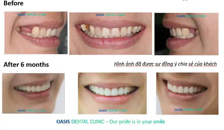 Hình ảnh nha-khoa-oasis-oasis-dental-clinic-4