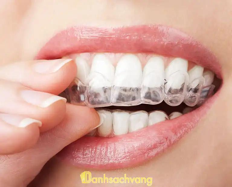 Hình ảnh dia-chi-nieng-rang-trong-suot-invisalign-tai-tphcm