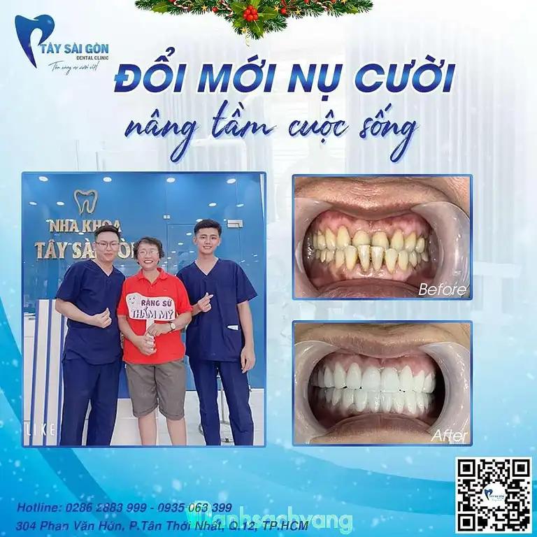 Hình ảnh nha-khoa-tay-sai-gon-phan-van-hon-quan-12-tphcm-4