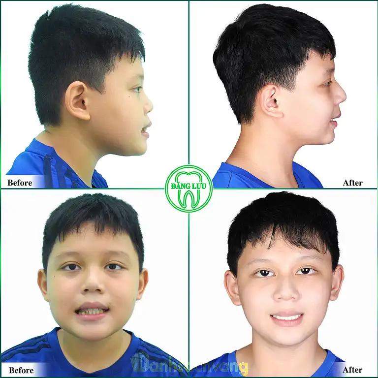 Hình ảnh nha-khoa-dang-luu-kha-van-can-thu-duc-tphcm-2