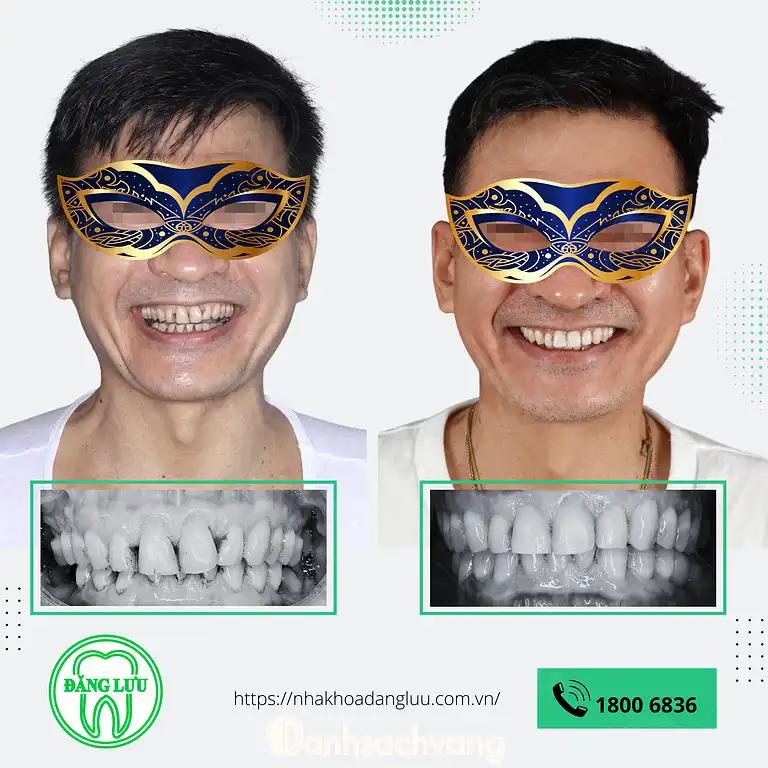 Hình ảnh nha-khoa-dang-luu-kha-van-can-thu-duc-tphcm-3