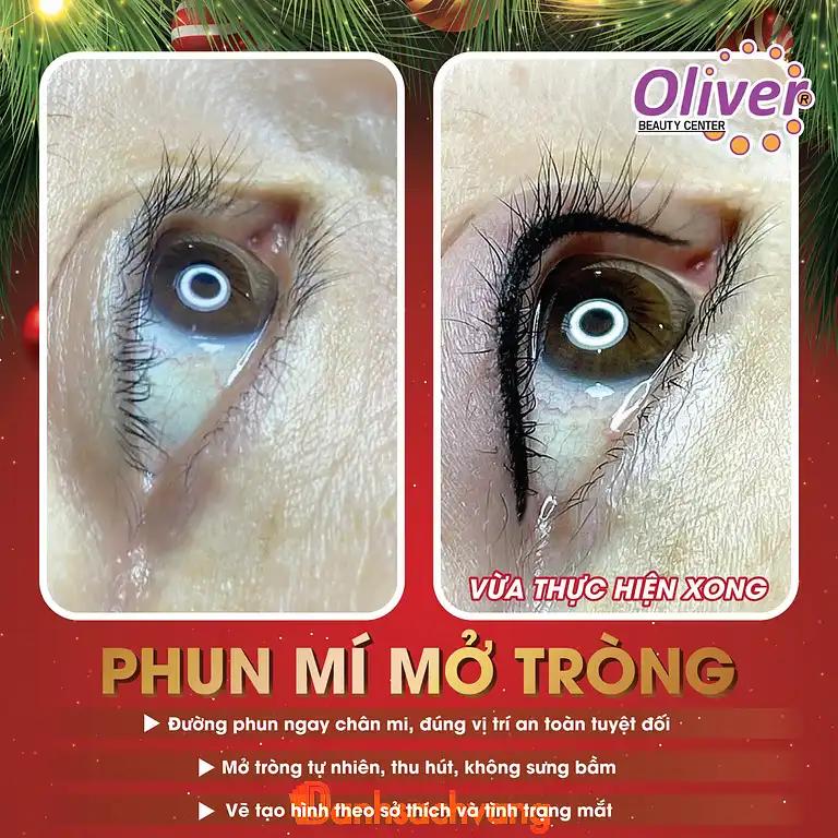 Hình ảnh vien-tham-my-oliver-nguyen-duy-trinh-quan-2-thcm-4