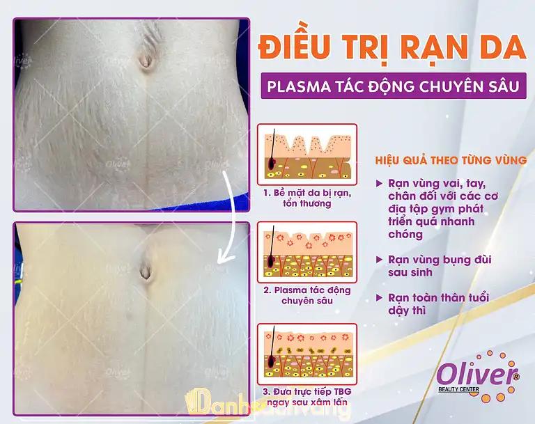 Hình ảnh vien-tham-my-oliver-nguyen-duy-trinh-quan-2-thcm-3