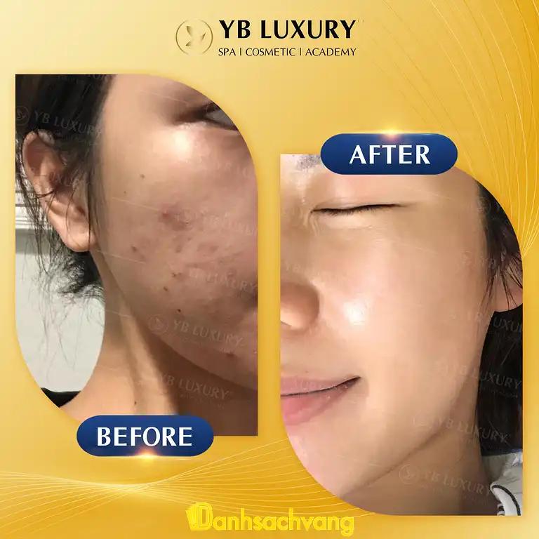 Hình ảnh yb-spa-tran-thi-nghi-q-go-vap-tphcm-4