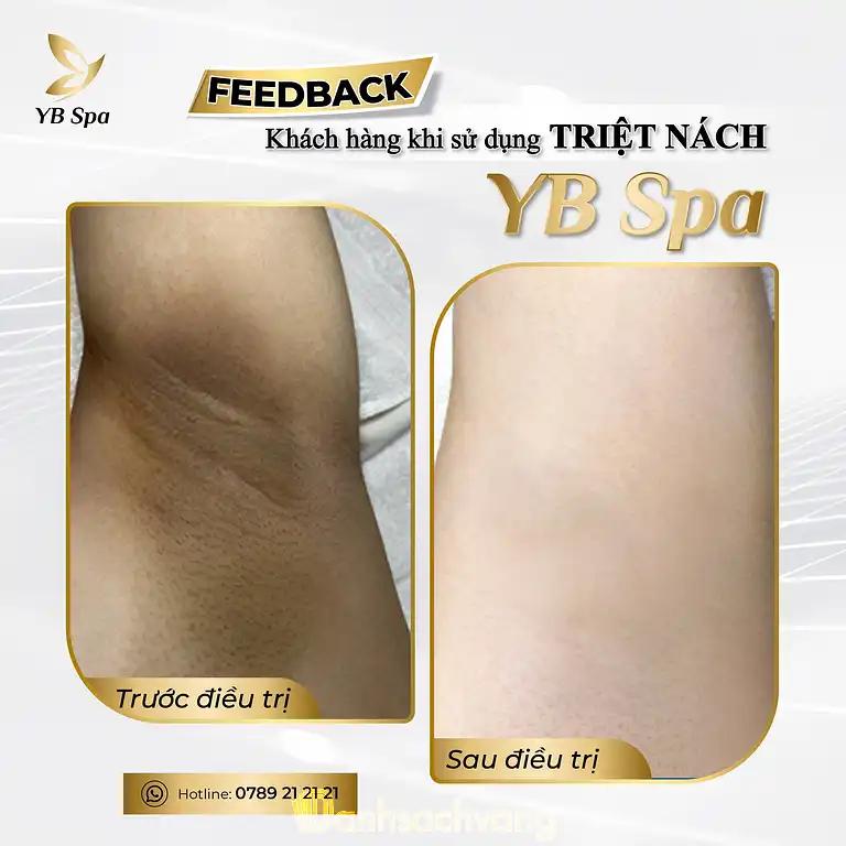 Hình ảnh yb-spa-tran-thi-nghi-q-go-vap-tphcm-5