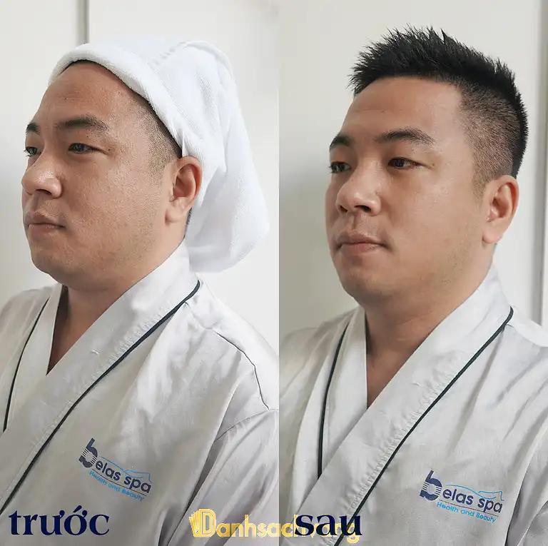 Hình ảnh belas-spa-clinic-vo-van-tan-2