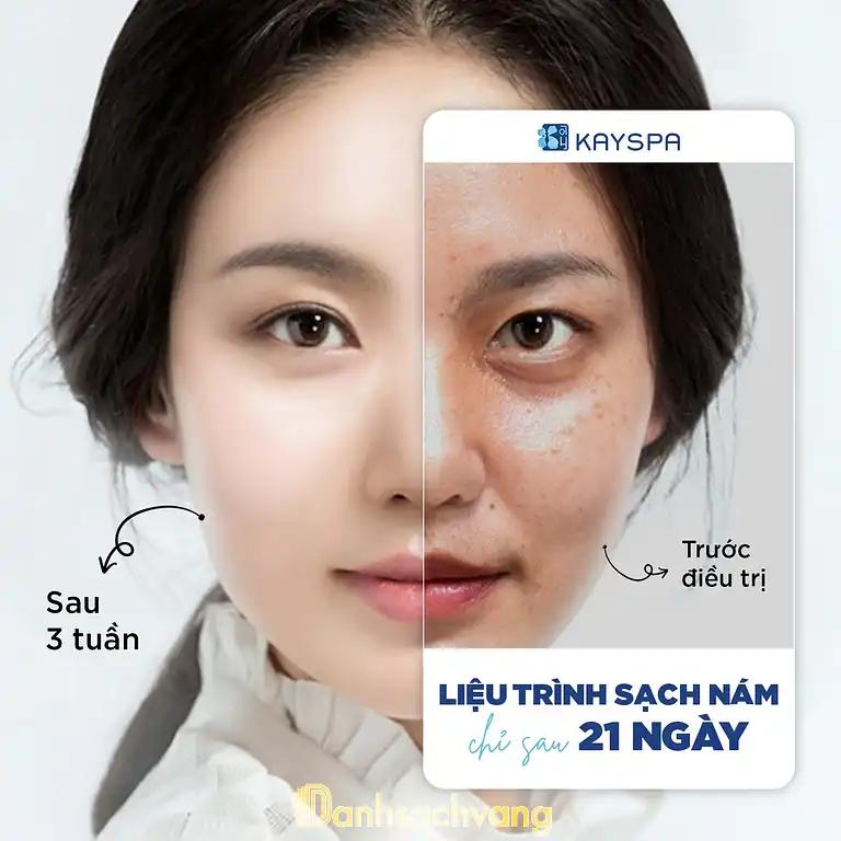 Hình ảnh kay-spa-3-thang-2-quan-10-tphcm-3
