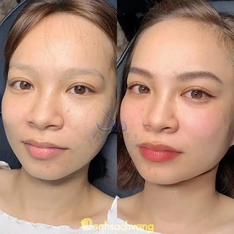 Hình ảnh tham-my-vien-quoc-te-so-beauty-2