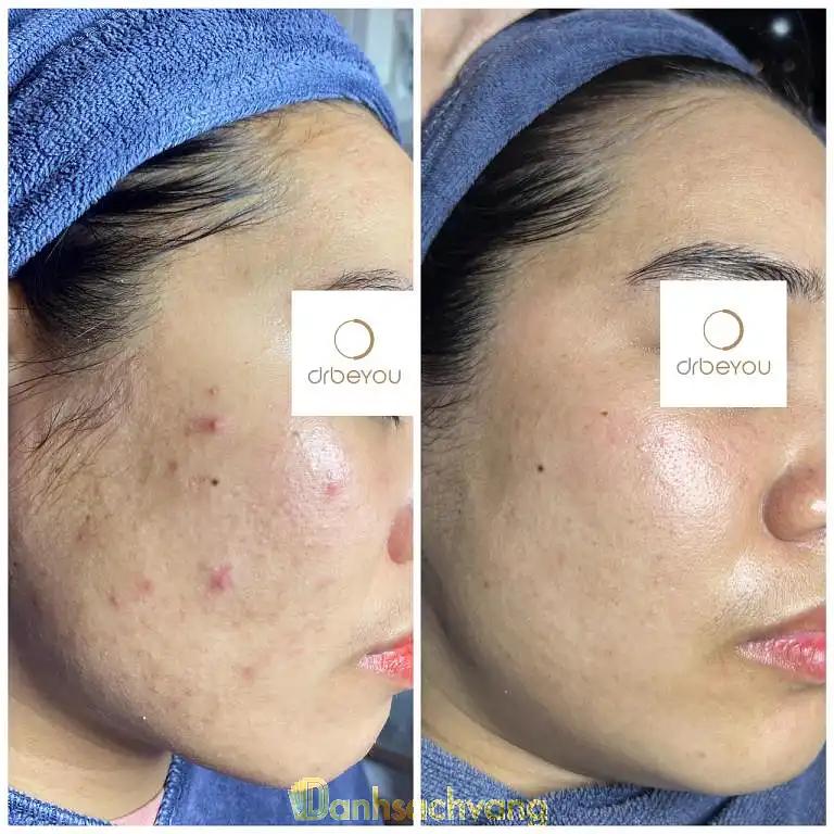 Hình ảnh quin-skin-le-van-luong-5
