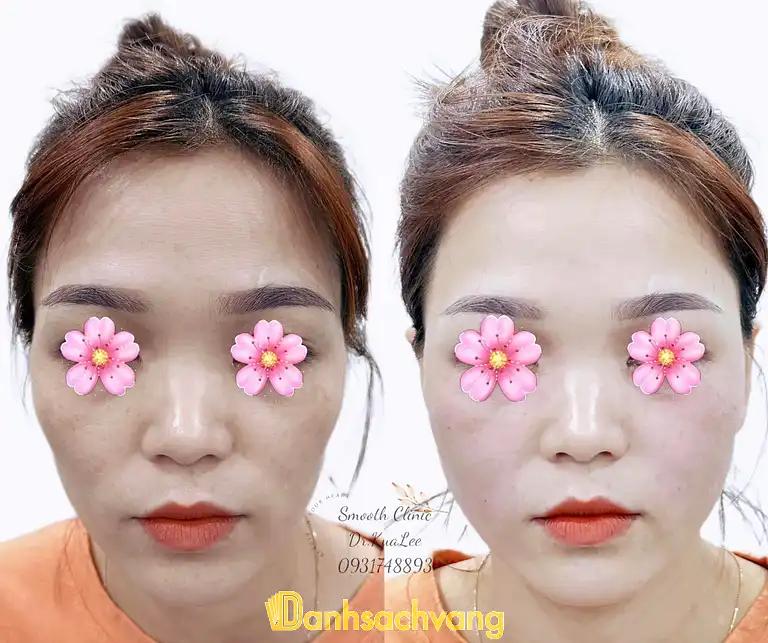 Hình ảnh smooth-beauty-2