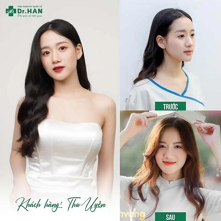 Hình ảnh Viện Thẩm Mỹ Quốc Tế Dr. Han:  224 Trần Duy Hưng, Cầu Giấy