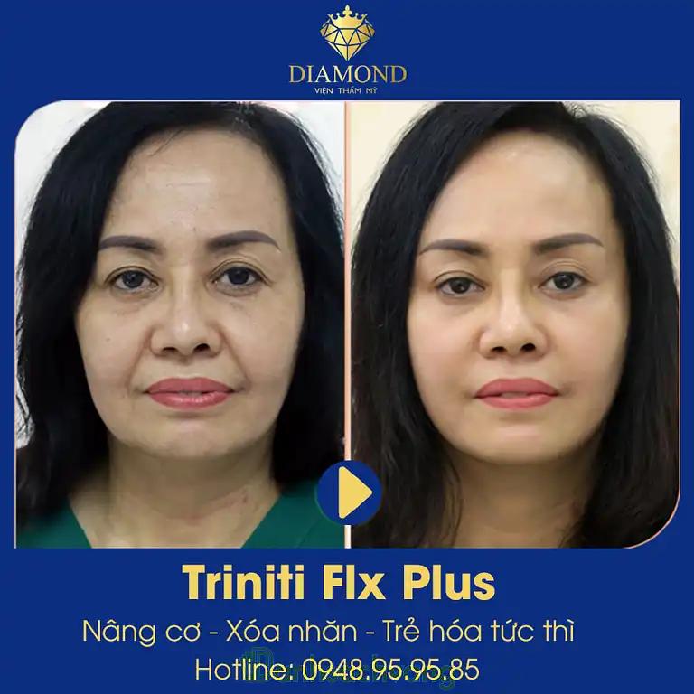 Hình ảnh Thẩm mỹ viện Diamond-4