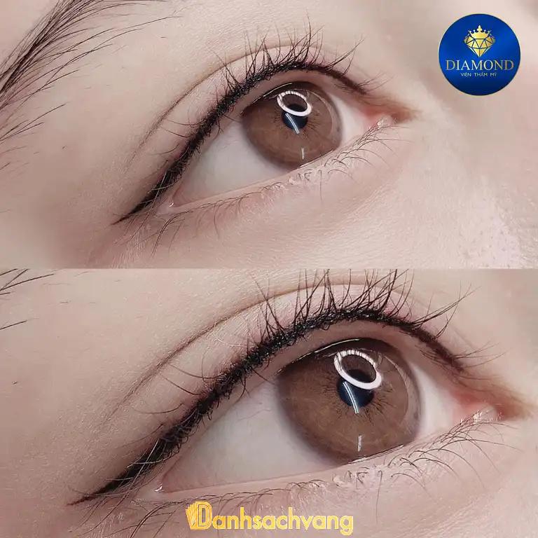 Hình ảnh Thẩm mỹ viện Diamond-3