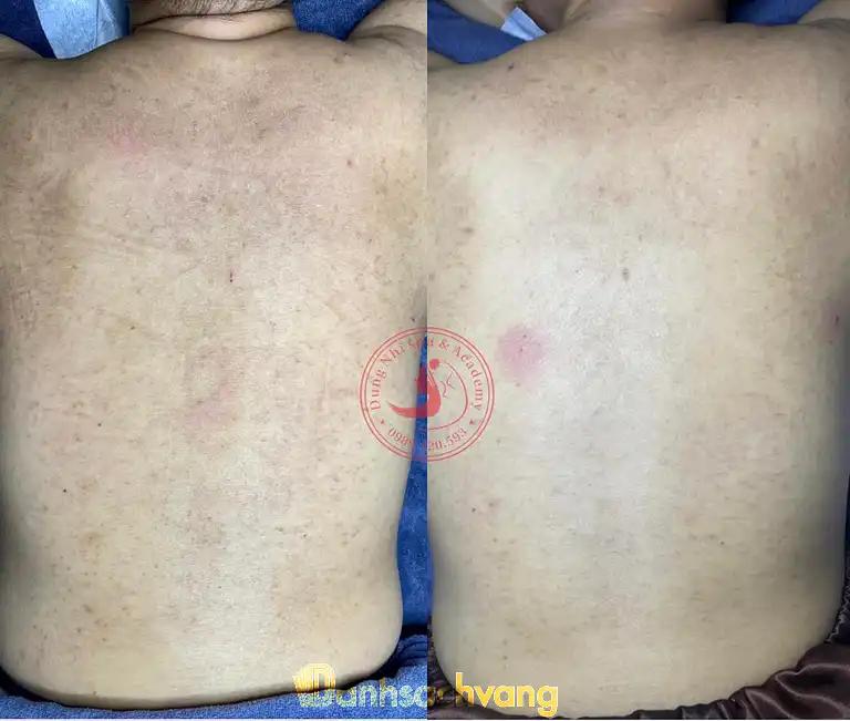 Hình ảnh dung-nhi-skin-spa-ha-noi-5