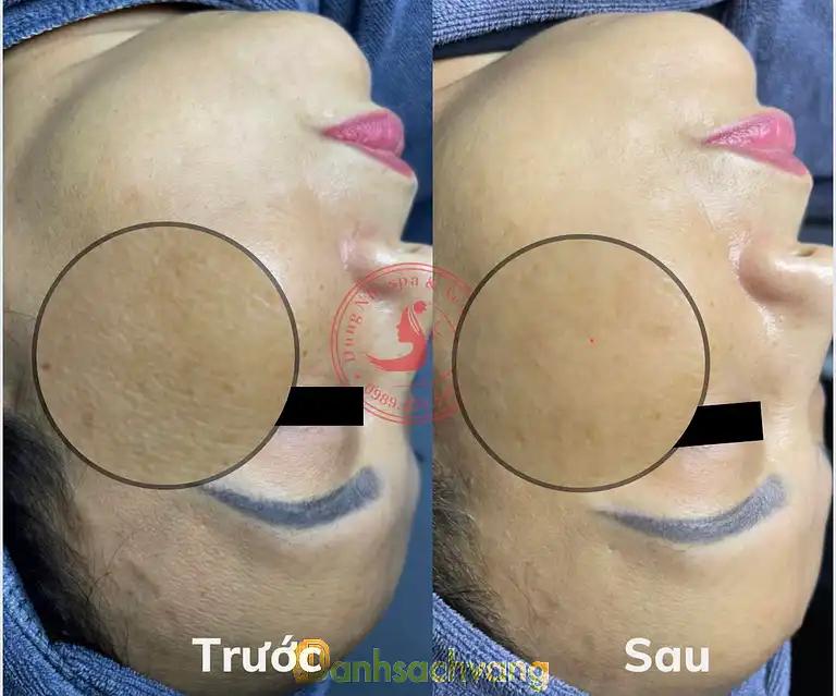 Hình ảnh dung-nhi-skin-spa-ha-noi-3