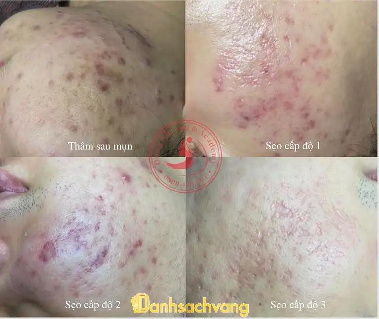 Hình ảnh dung-nhi-skin-spa-ha-noi-4