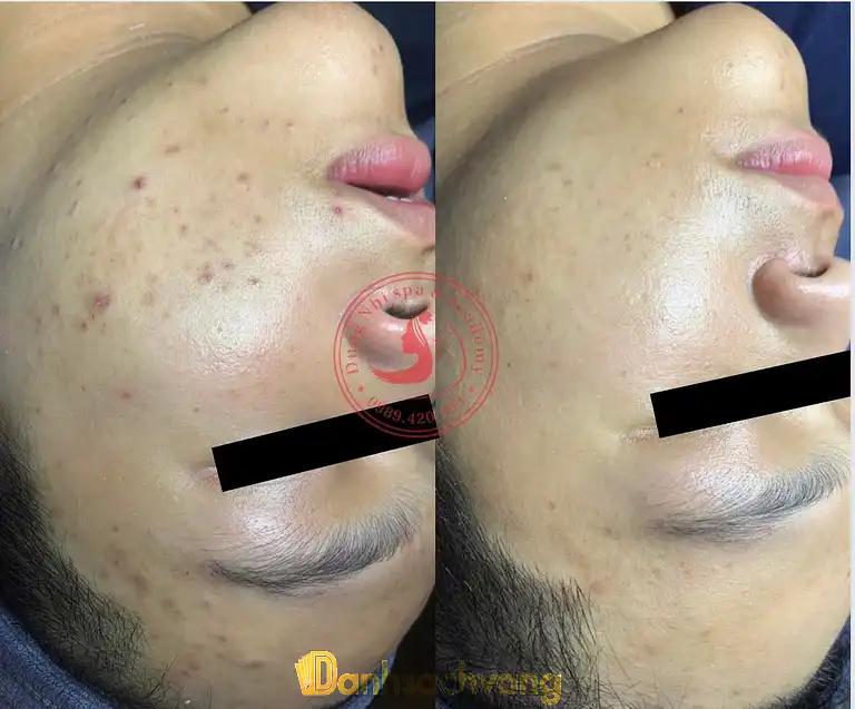 Hình ảnh dung-nhi-skin-spa-ha-noi-2