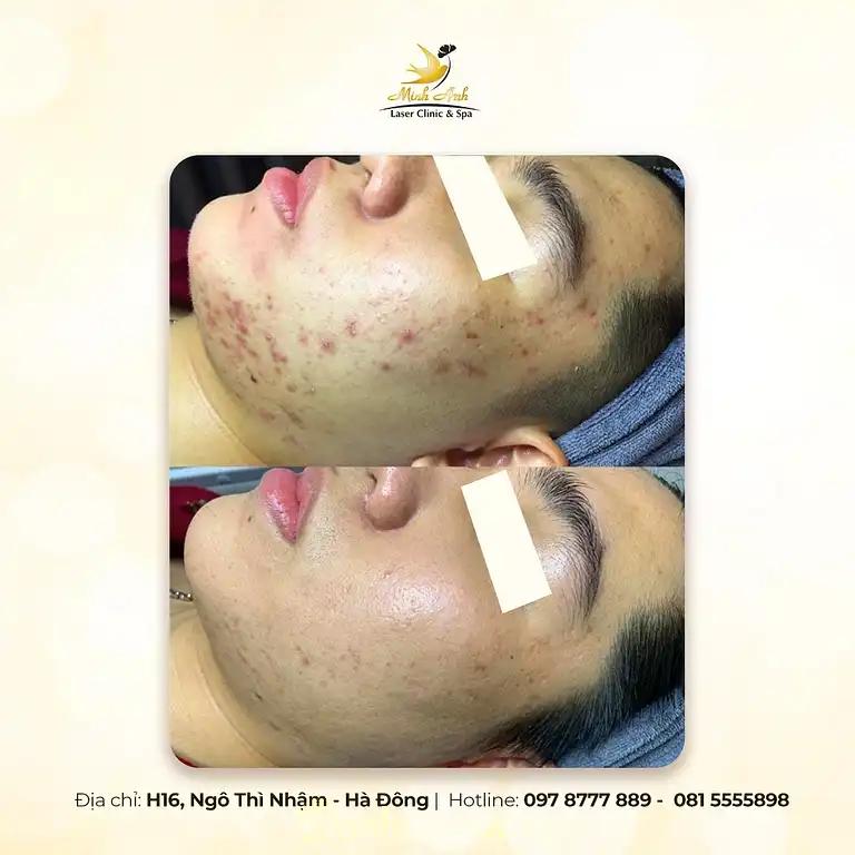 Hình ảnh Minh Anh Spa: H16 Ngô Thì Nhậm, Hà Đông