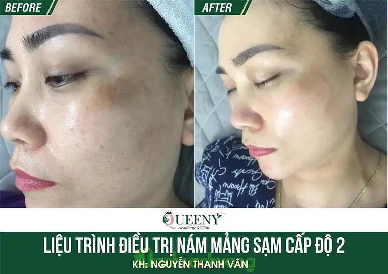 Hình ảnh queeny-beauty-center-260-ba-trieu-hai-ba-trung-2