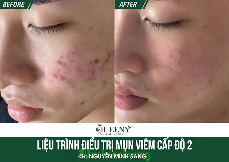 Hình ảnh queeny-beauty-center-260-ba-trieu-hai-ba-trung-4