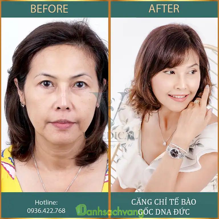 Hình ảnh v-medical-spa-68-le-van-huu-hai-ba-trung-4