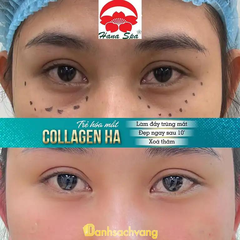 Hình ảnh hana-spa-co-so-2-2