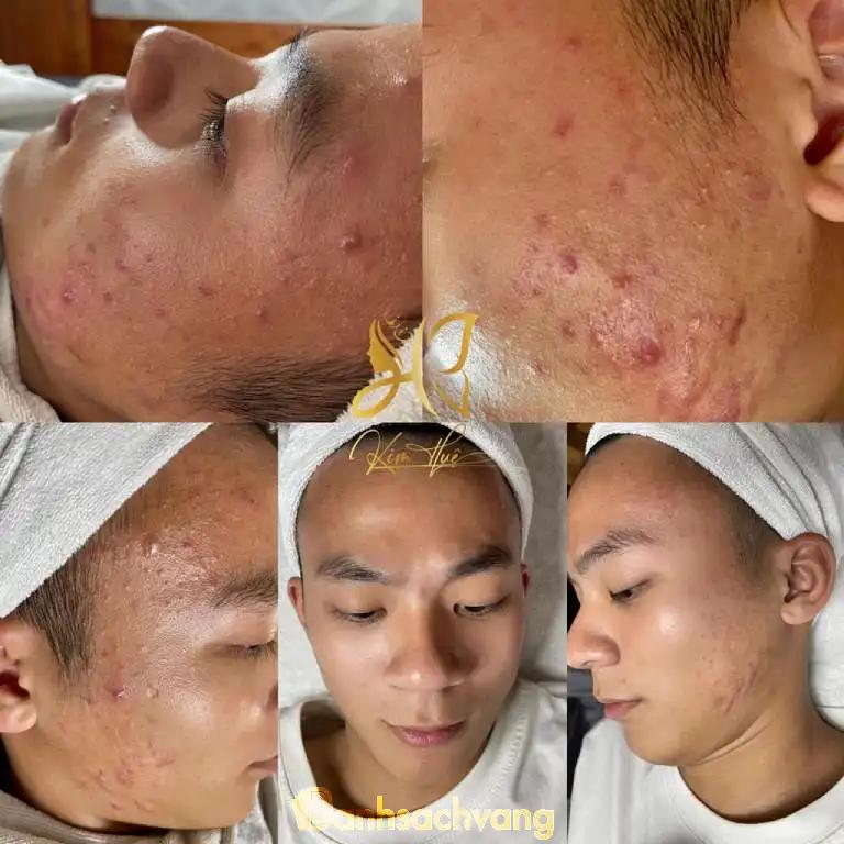 Hình ảnh spa-kim-hue-172-lacasta-ha-dong-3
