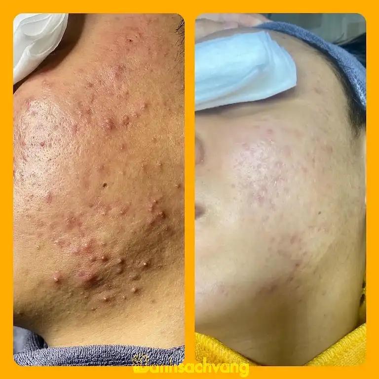 Hình ảnh ada-beauty-spa-academy-8a95-chien-thang-ha-dong-4