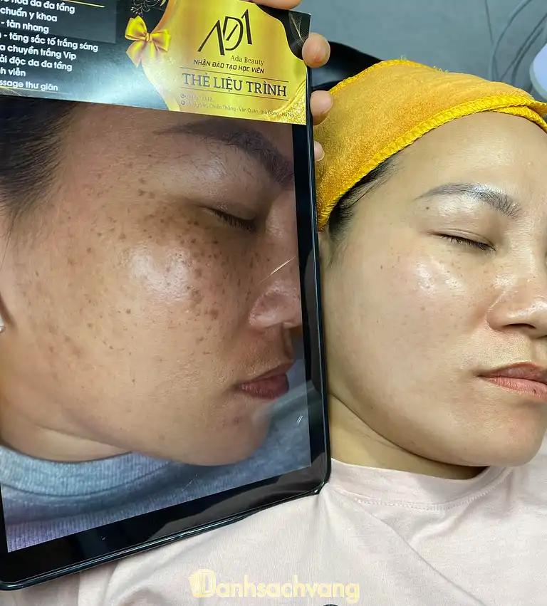 Hình ảnh ada-beauty-spa-academy-8a95-chien-thang-ha-dong-2