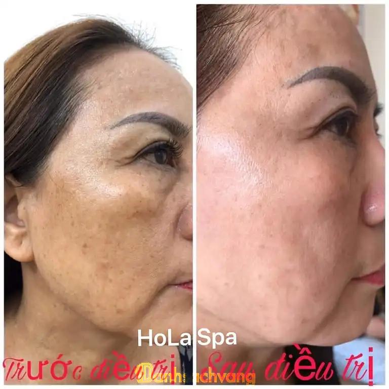 Hình ảnh hola-spa-1614-go-meo-dan-phuong-2