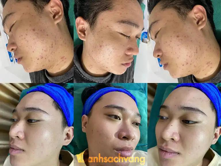 Hình ảnh herrin-spa-tran-phuong-kdt-tan-tay-do-dan-phuong-4