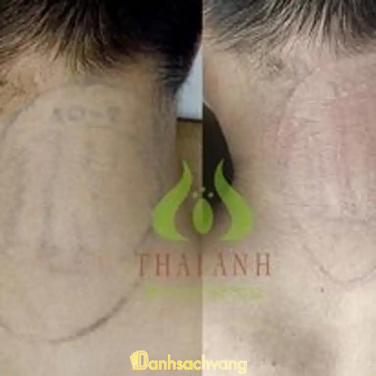 Hình ảnh thai-anh-beauty-spa-me-tri-nam-tu-liem-3