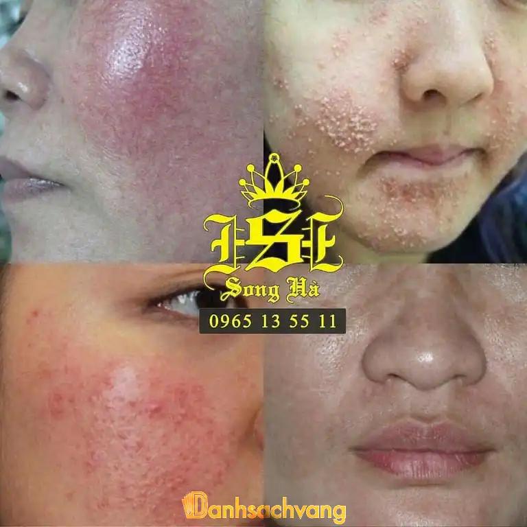 Hình ảnh song-ha-spa-clinic-753-ngo-xuan-quang-gia-lam-4