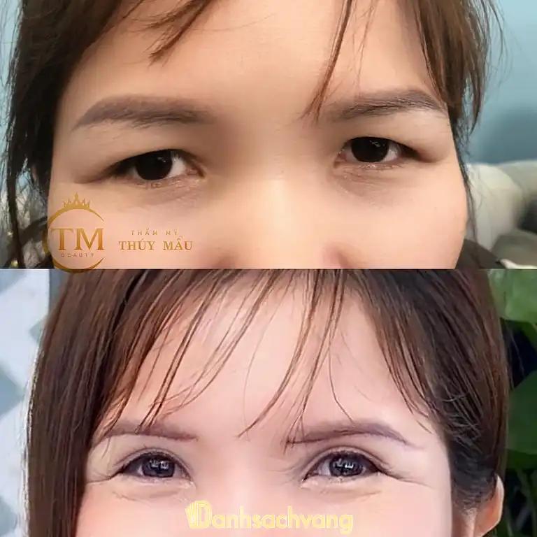 Hình ảnh tham-my-thuy-mau-x2-dong-tru-dong-anh-3
