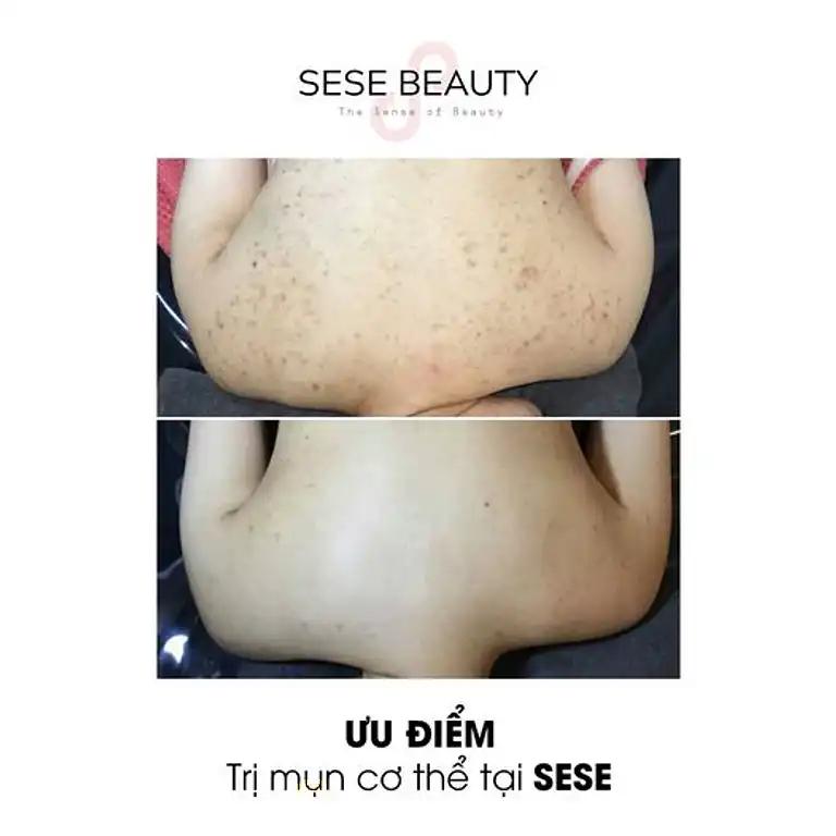 Hình ảnh sese-beauty-123-trieu-viet-vuong-hai-ba-trung-2