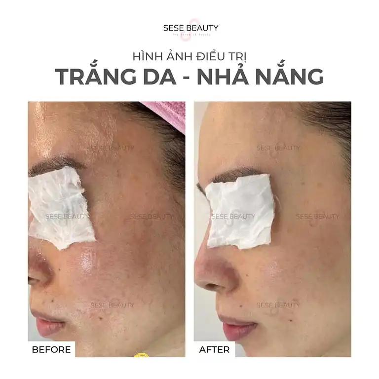 Hình ảnh sese-beauty-123-trieu-viet-vuong-hai-ba-trung-3