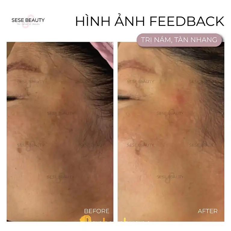 Hình ảnh sese-beauty-123-trieu-viet-vuong-hai-ba-trung-4